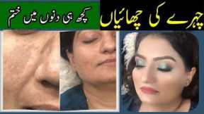 How To Cover Up Freckles | Easy Makeup Steps || Pigmentation cover base || Bonus Tip || (Part 2)