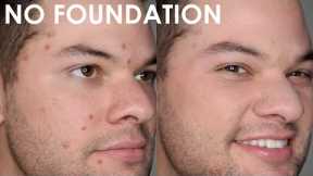How To Cover a Pimple With Makeup for Men and Women - Natural Looking Acne Coverage (No Foundation)