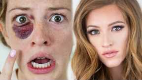 BLACK EYE to BEAUTIFUL - Cover Up Makeup Tutorial