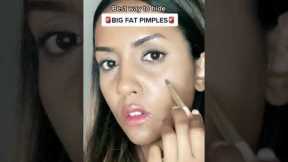 HIDE BIG PIMPLES (MAKEUP HACK)