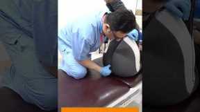 CHIROPRACTIC IN INDIA | SACRUM PAIN | COCCYDYNIA | DR. VARUN DUGGAL CHIROPRACTIC IN INDIA #shortfeed