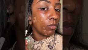 I covered my ACNE spots with Concealer and it turned out… 😳👀 #makeup